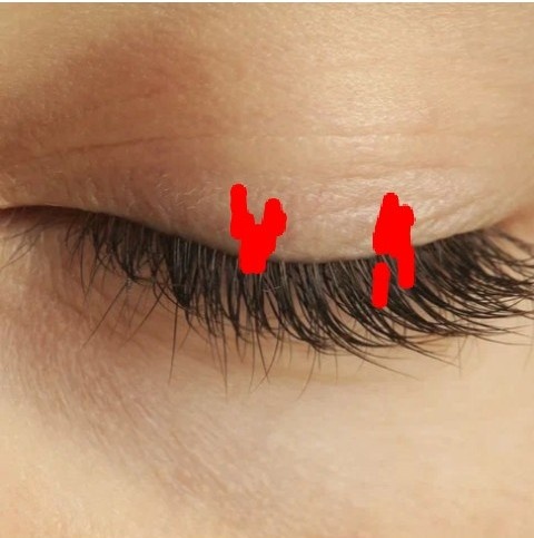 места где надо блокировать возможность движение глаз