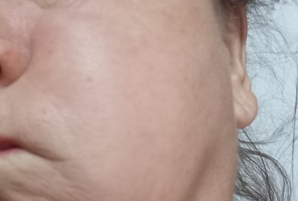 к чему прикусить правую щеку