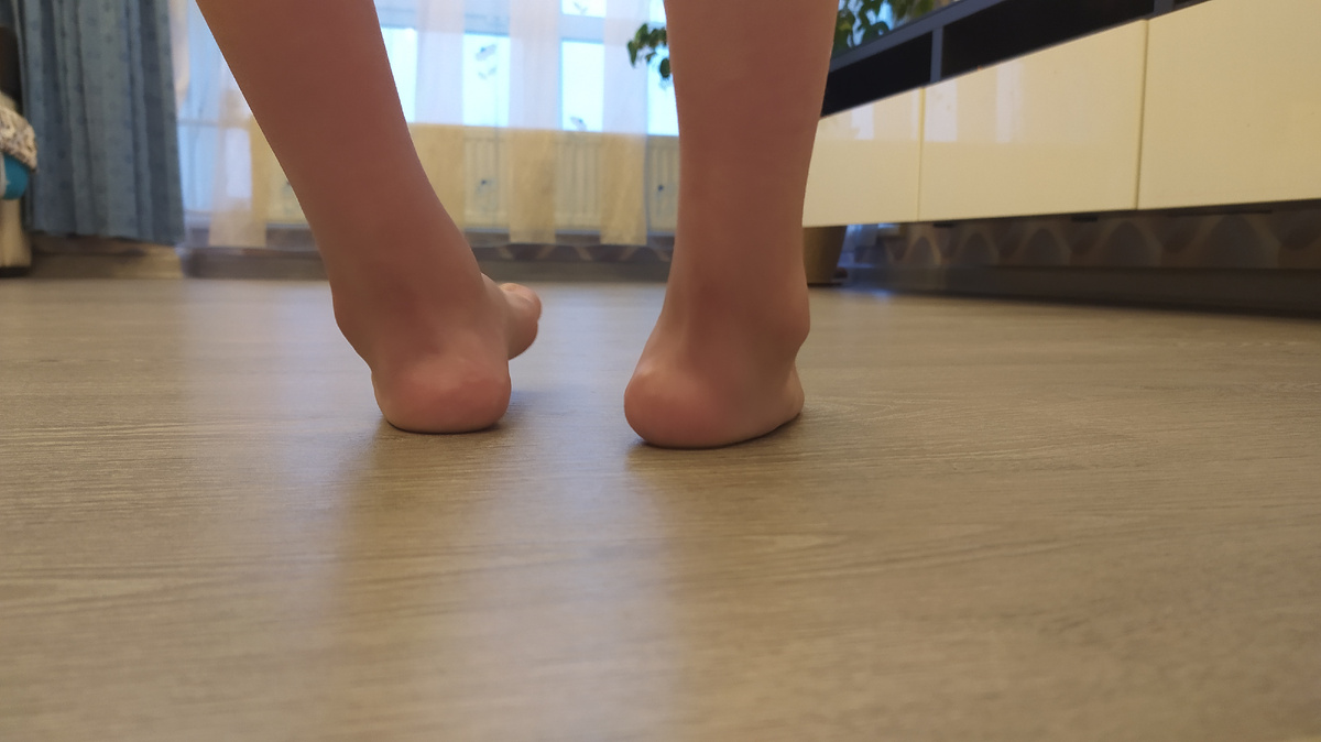 Врачу не нравилась правая нога (на фото также правая)