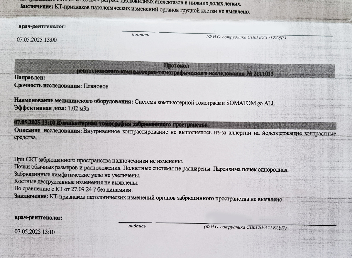 Результаты КТ