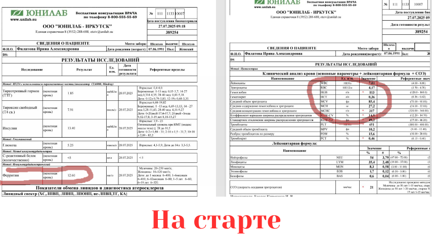 Анемия: мои промежуточные результаты в лечении