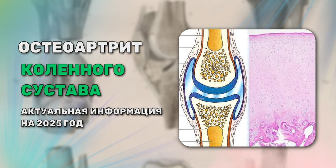 Как сохранить и защитить колено от разрушения?
