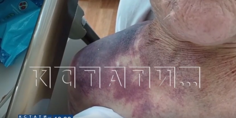 Фото: скриншот видео программы "Кстати".