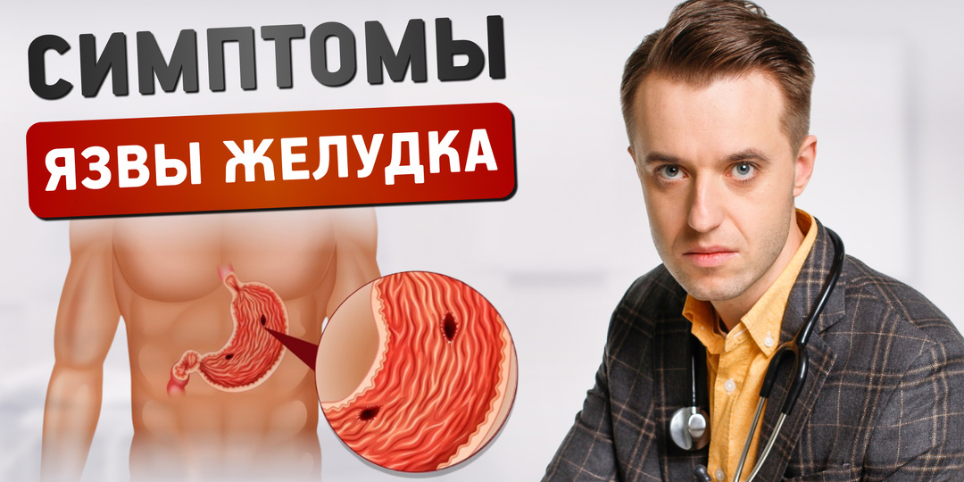 Язва желудка: симптомы, причины и когда нужно срочно обращаться к врачу