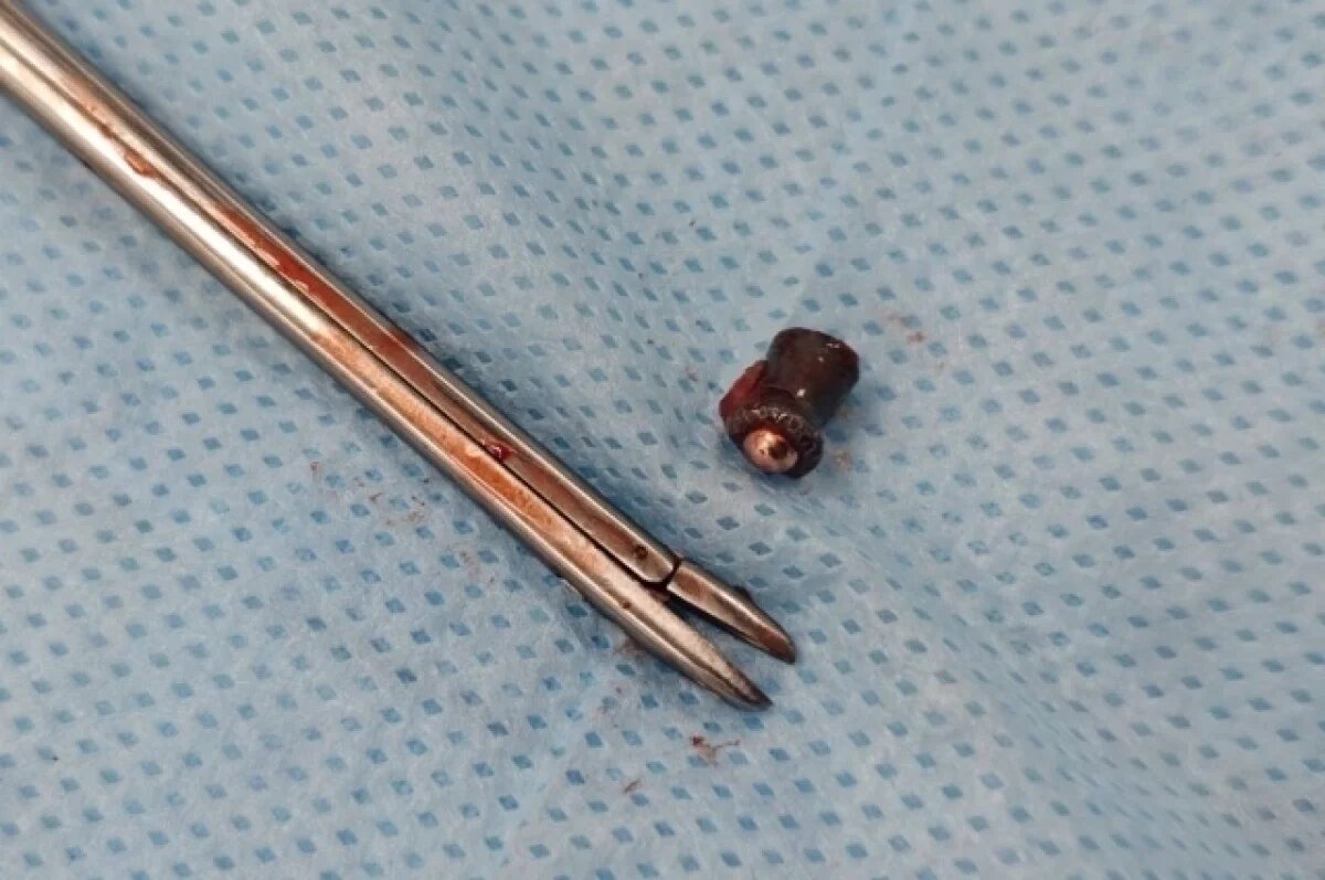    Следы от пуль обнаружил реставратор читинского оленя