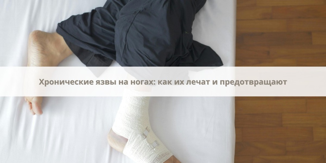 Хронические язвы на ногах чаще всего возникают из-за нарушенного кровообращения, диабета или длительных воспалительных процессов