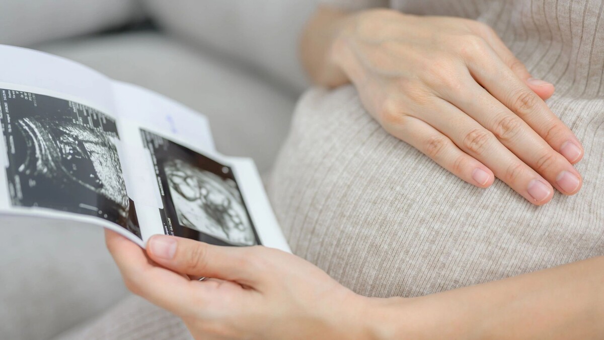    Фото: BELL KA PANG / Shutterstock / Fotodom