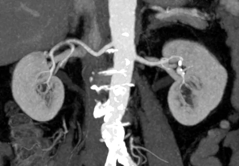                                  Когда надо делать КТ с контрастом