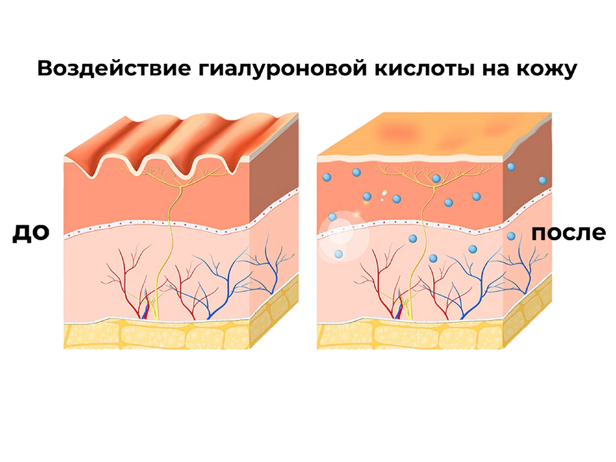 Воздействие 