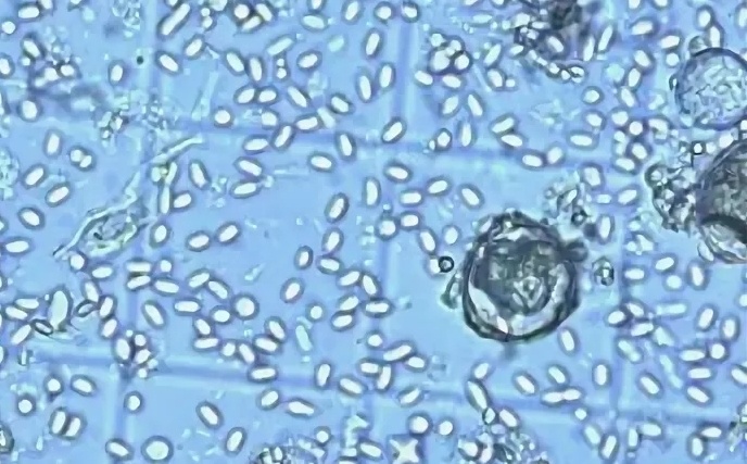 Нозематоз под микроскопом