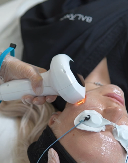 Выполнение процедуры Lumecca. 