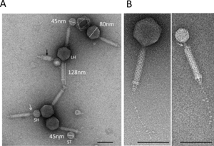 Электронно-микроскопические снимки бактериофагов (вирусов, поражающих бактерии).
На панели A видно несколько фагов с разными размерами головки (капсида) и хвостовой структуры. Подписаны размеры:
головка ~45–80 нм,
хвост ~128 нм.
На панели B — увеличенные изображения отдельных фагов. Хорошо видны: головка (где находится генетический материал), хвост с чёткой структурой (используется для прикрепления к бактериальной клетке и инъекции ДНК/РНК).