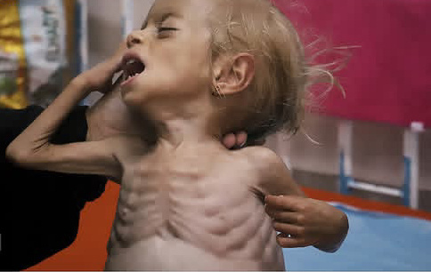 Щам только что прибывшая из Газы 