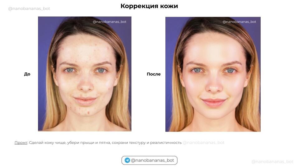 -11