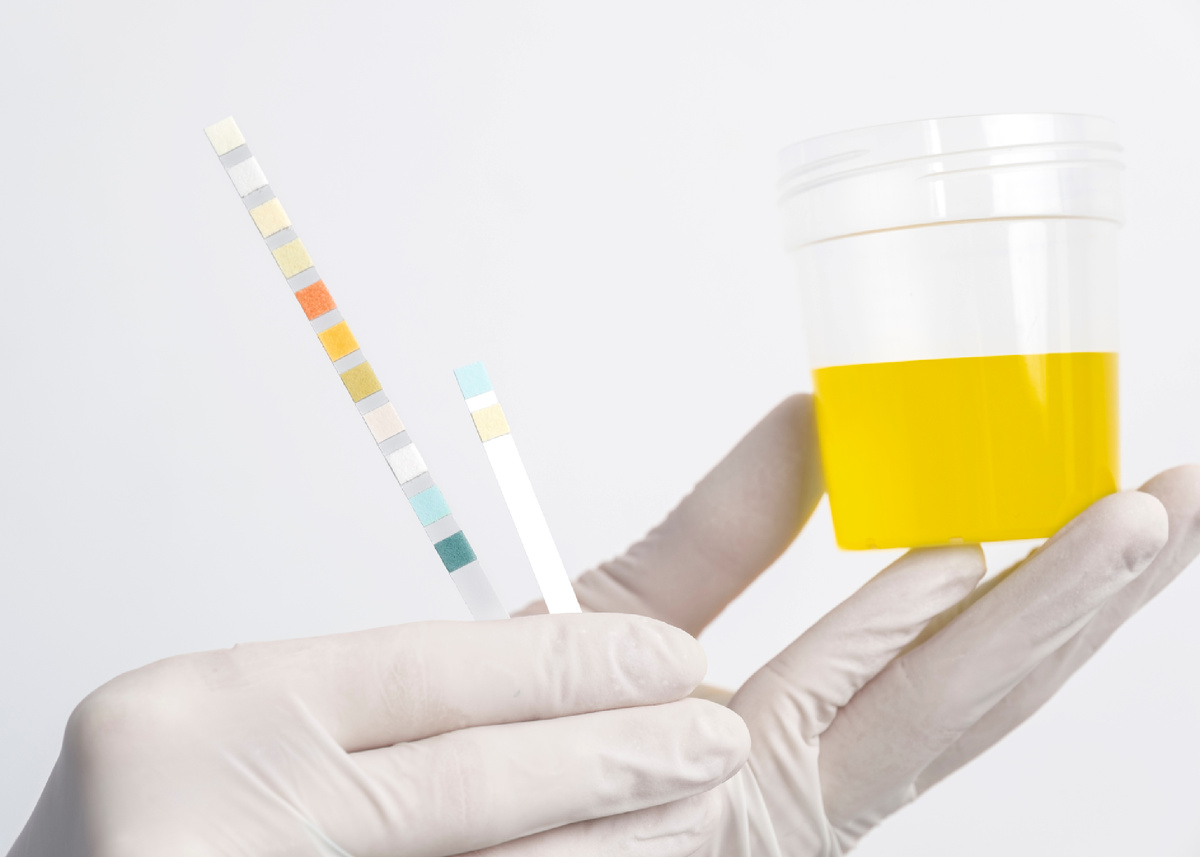https://ru.freepik.com/free-photo/lab-doctor-performing-medical-exam-urine_25182623.htm