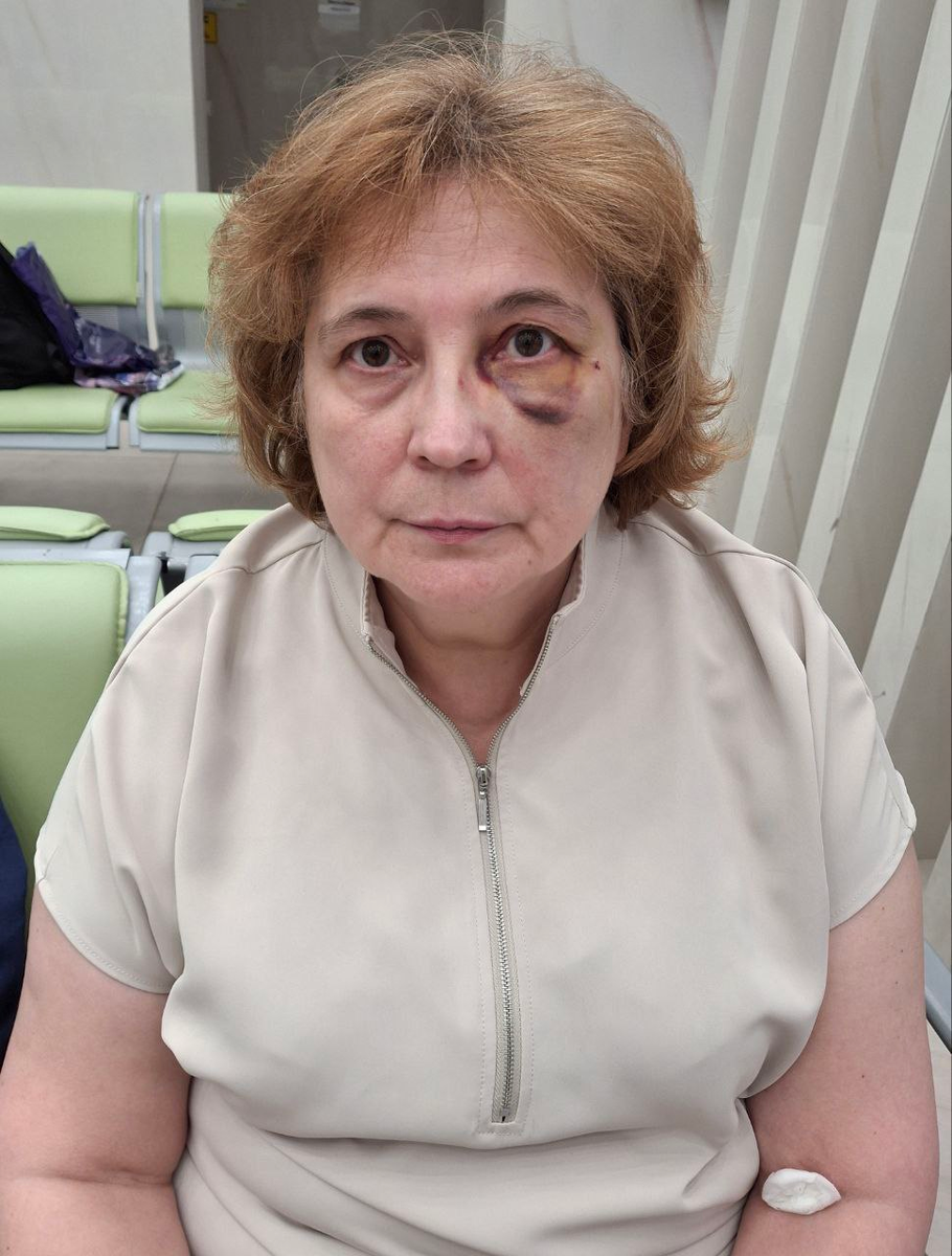 Есть много других фото, но Дзен не пропустит