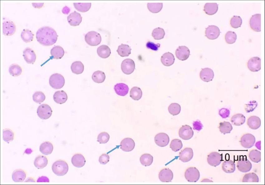 микоплазмы на эритроцитах
