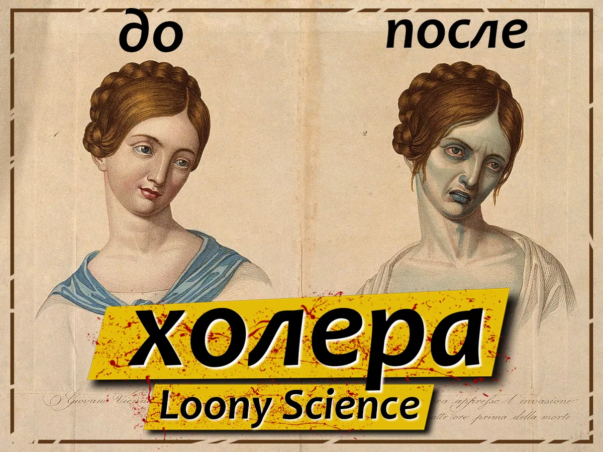 Холера.