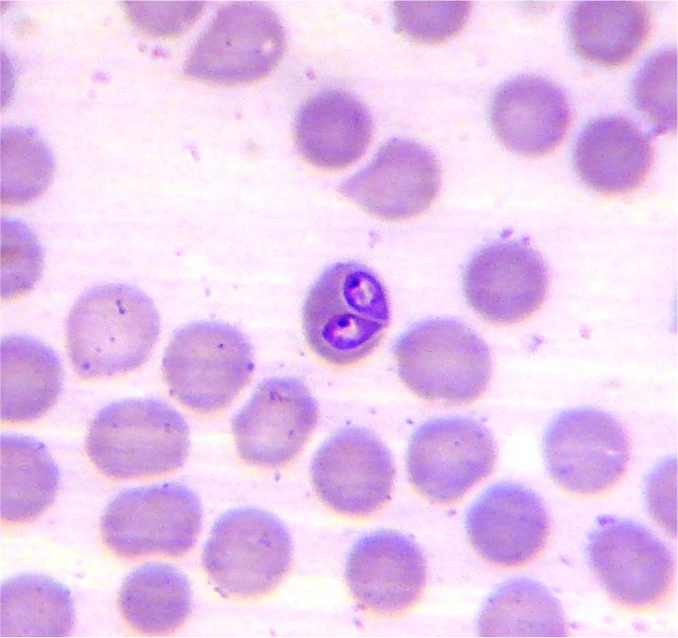 Микроскопия крови собаки. Babesia canis