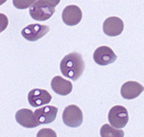 Babesia canis