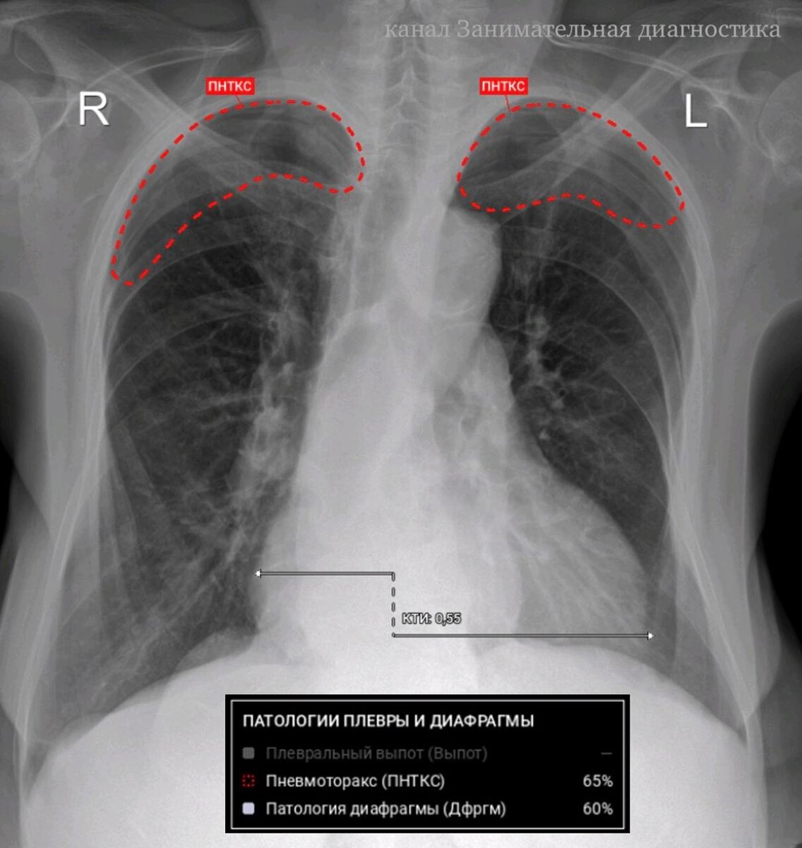  заключение и разметка ИИ