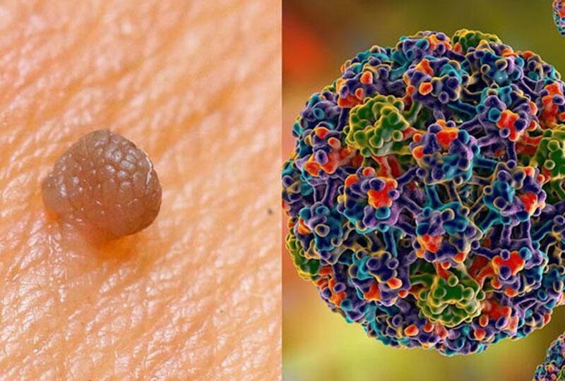 Они не появляются внезапно — они растут в тени. 12 правдивых истин о злокачественных новообразованиях, которые спасут тебе жизнь