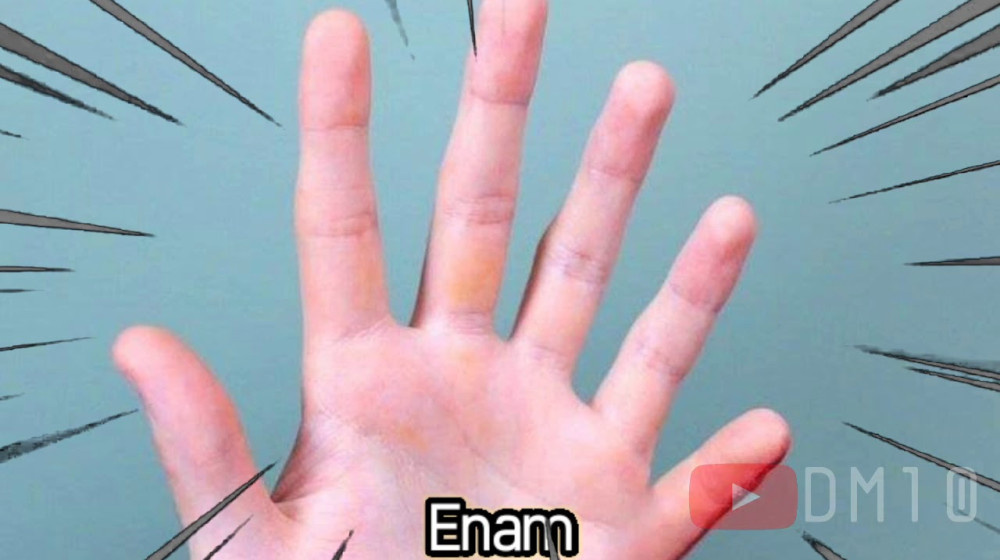    Шестой палец жива ли правда за этим редким явлением