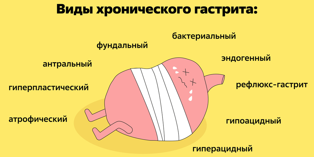 5 первых признаков гастрита