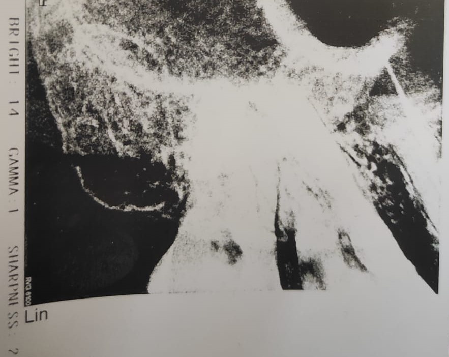 непонятный рентген в условно бесплатной поликлинике