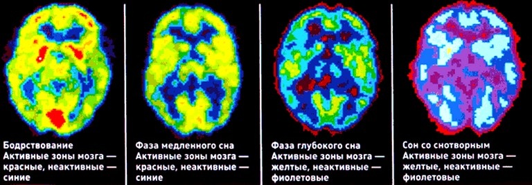 Графика работы мозга