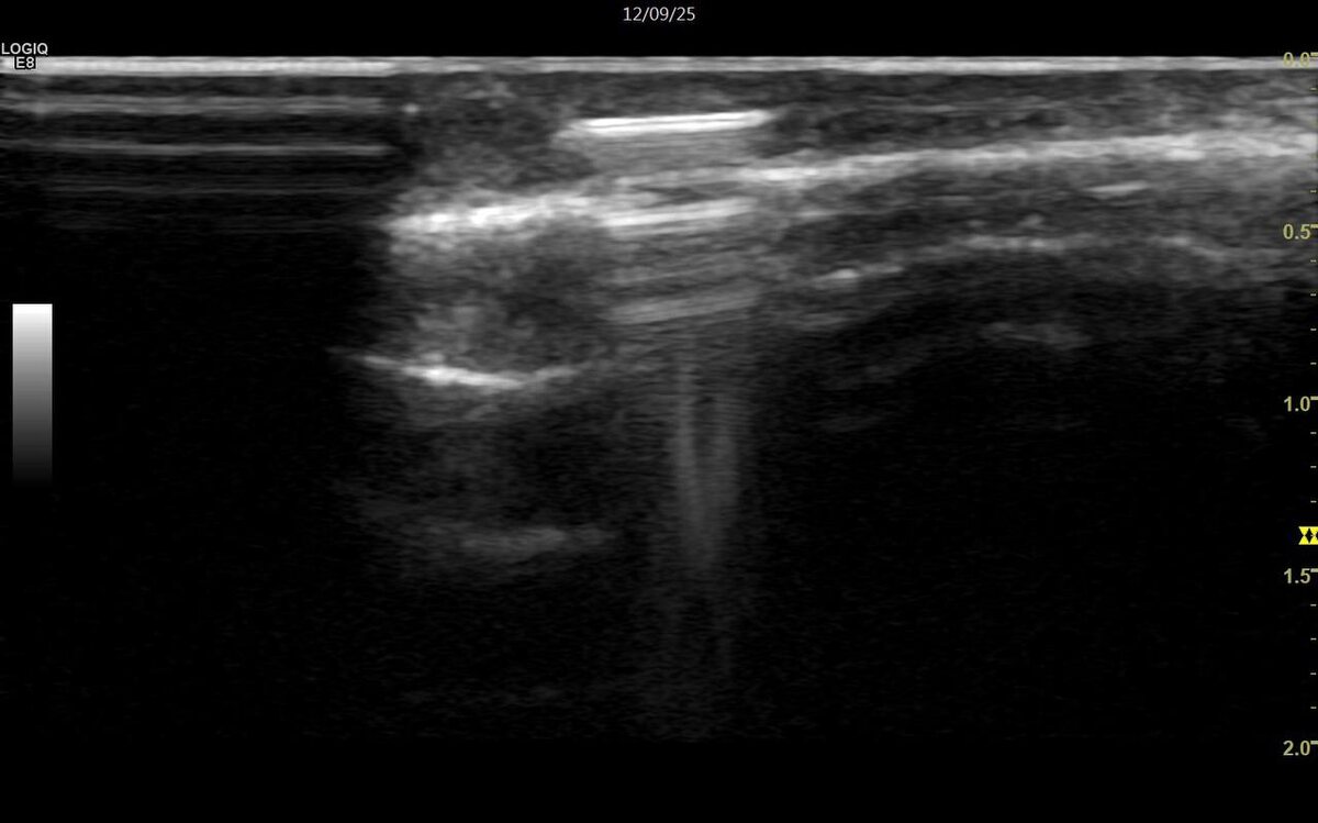 Вот так может выглядеть стекло при УЗ-иссулодании.