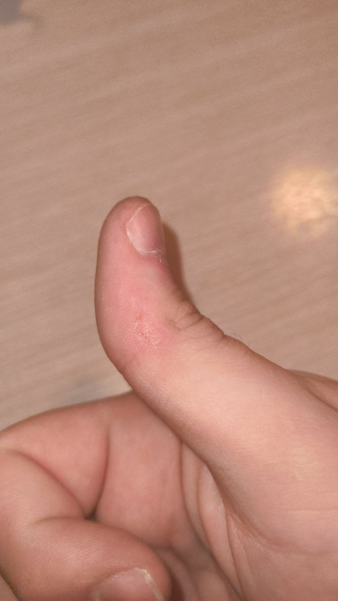 Реальное фото человека, который обратился ко мне за помощью