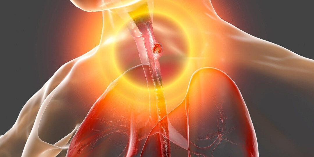 Врач объяснил, какие боли указывают на рак