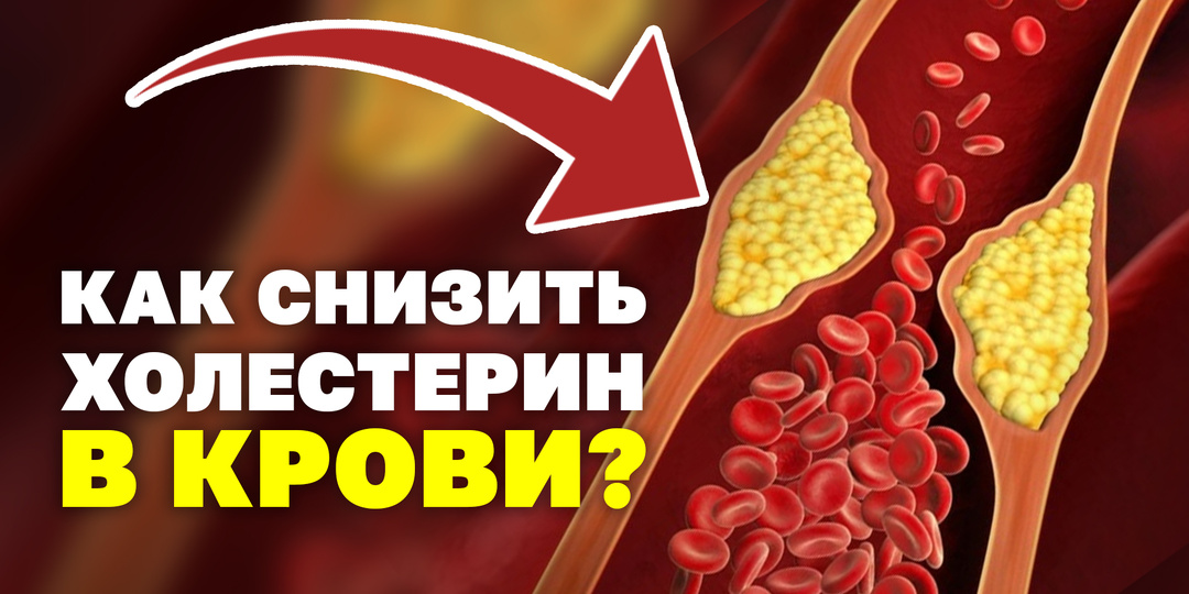 Врач рассказал, почему опасен высокий холестерин