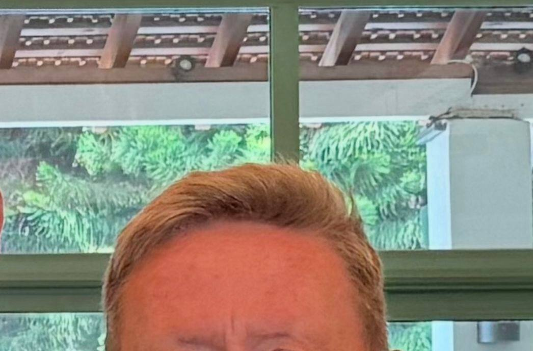 Вот пример отца моих детей, генетическая складка между бровей.