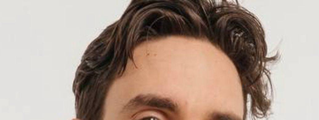 И вот старший сын 4 года назад, складка немного видна.