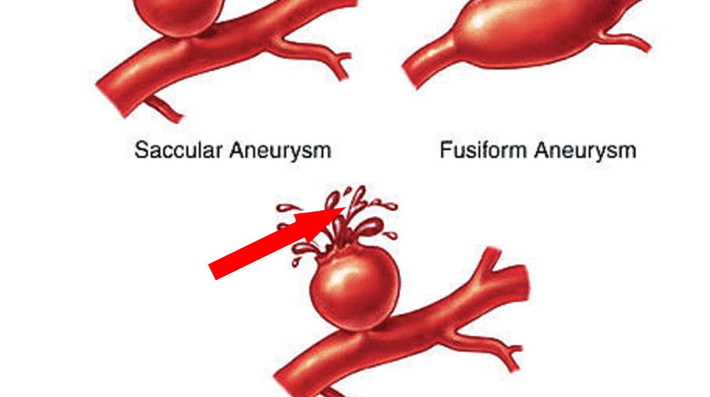    Сигнал изнутри не игнорируй — жизнь спасай