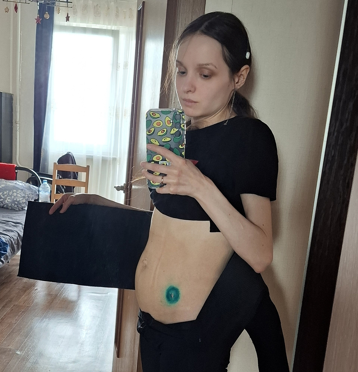 После ношения бандажа