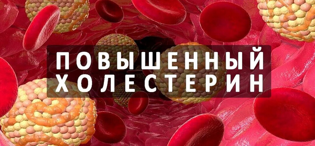 Все о препаратах для снижения холестерина: как они работают, кому нужны и что важно знать