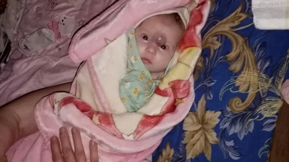 ГЕМАТОМА НА ВСЮ ЖИЗНЬ?