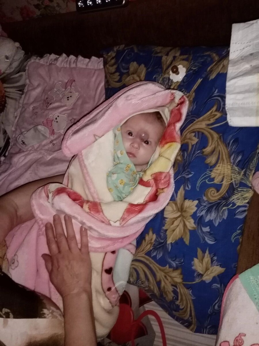 Маленькая Яна после выписки. Фото предоставлено владельцем