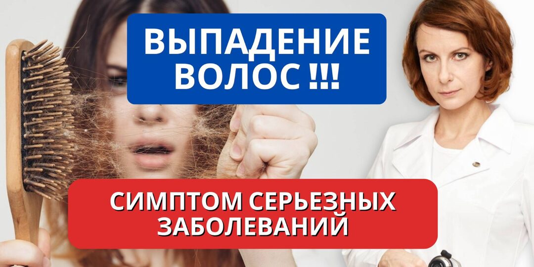 Выпадающие волосы: когда это признак болезни, а не косметики