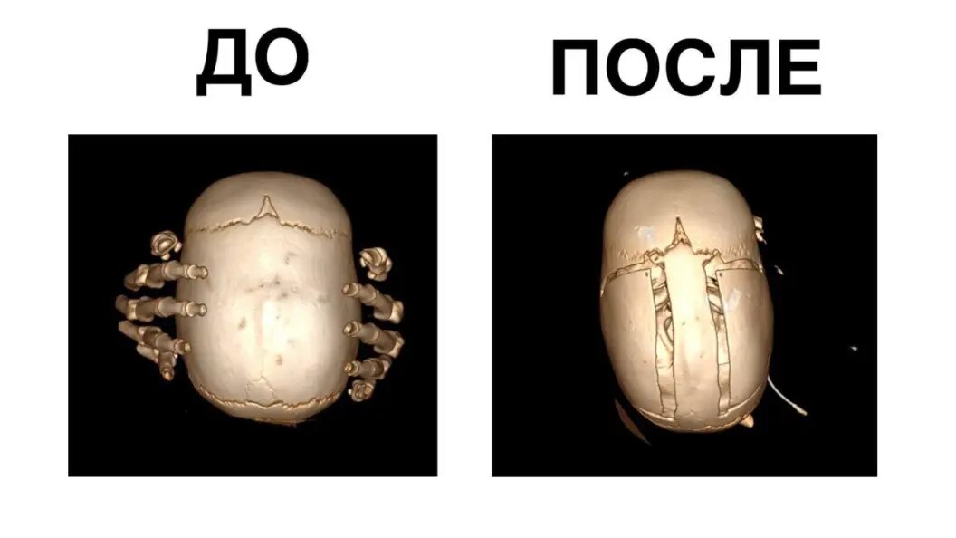   пресс-служба Минздрава Московской области