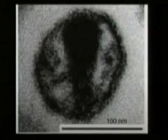 На фото: вирион ВИЧ на изображении, полученном со сканирующего электронного микроскопа.