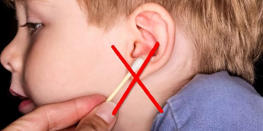 Серная пробка: как безопасно удалить её дома — и когда бежать к врачу