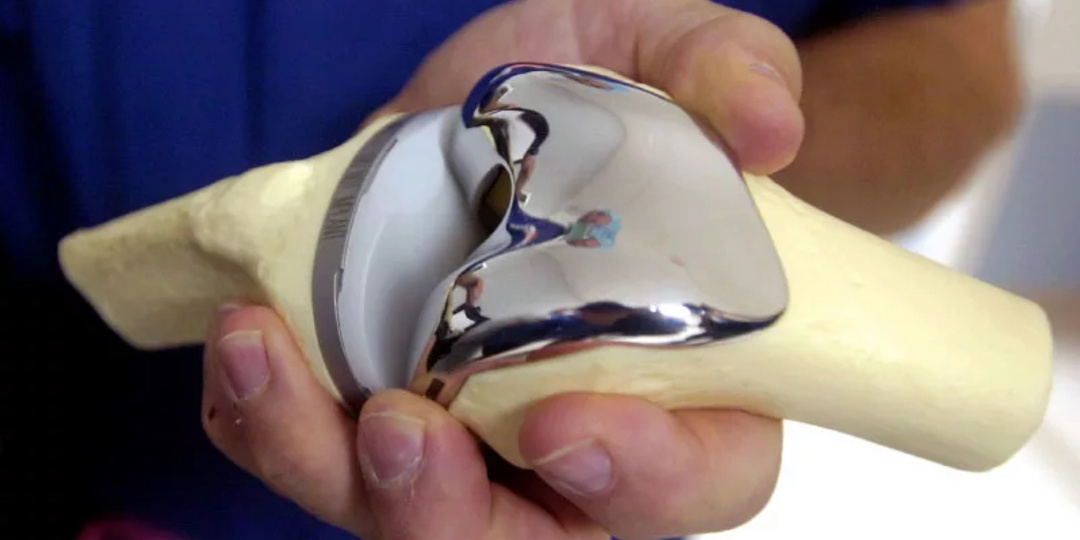 БОЛИТ ИСКУССТВЕННЫЙ СУСТАВ?