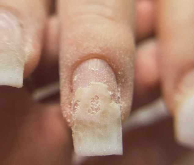 ОТСЛОЙКА — ПОРА ОБНОВИТЬ МАНИКЮР