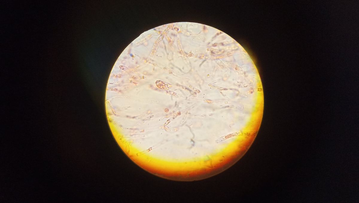 Микроструктуры гельвеллосебацины слипающейся
Фото А. Каретникова