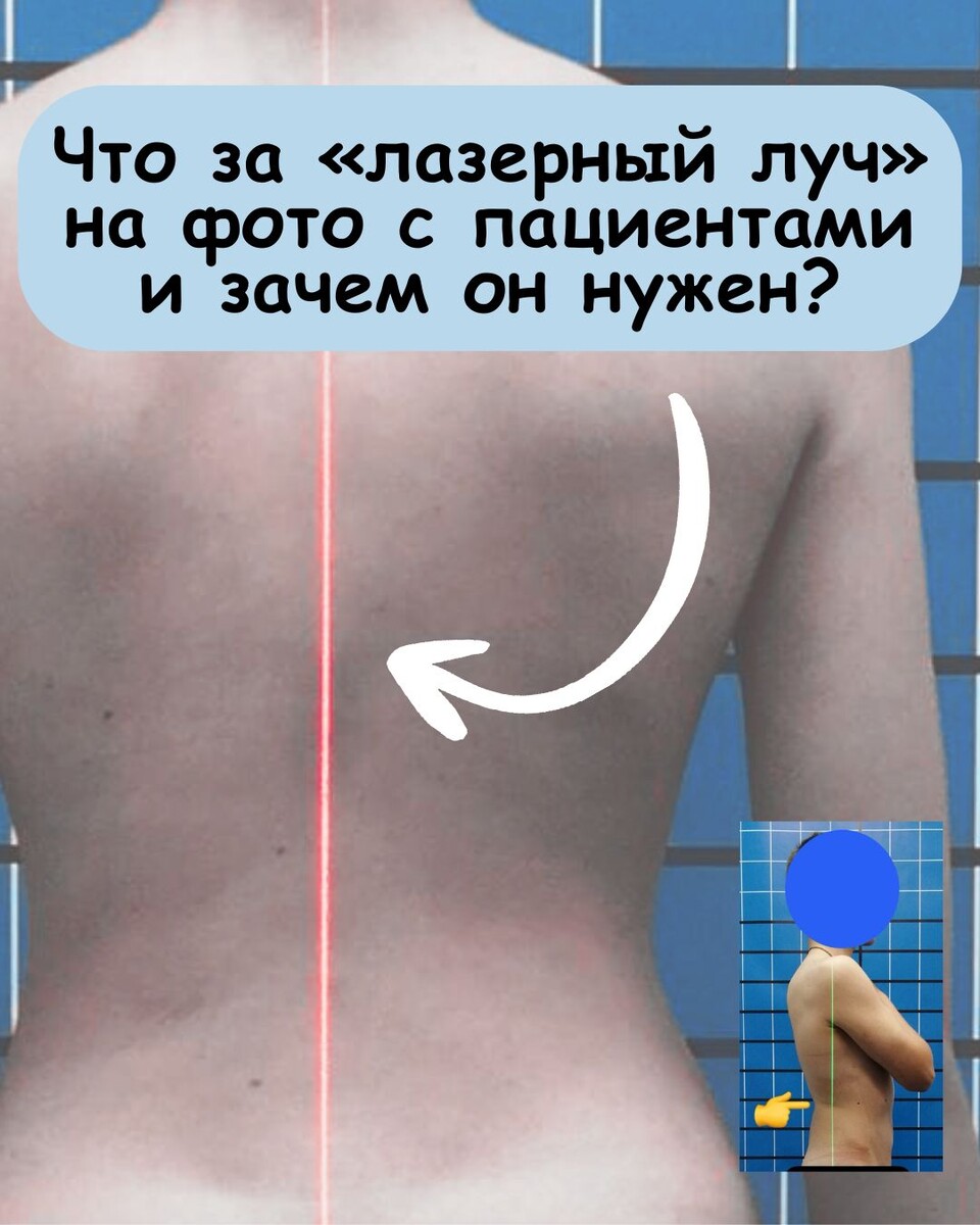 Что за «лазерный луч» на фото с пациентами и зачем он нужен?

