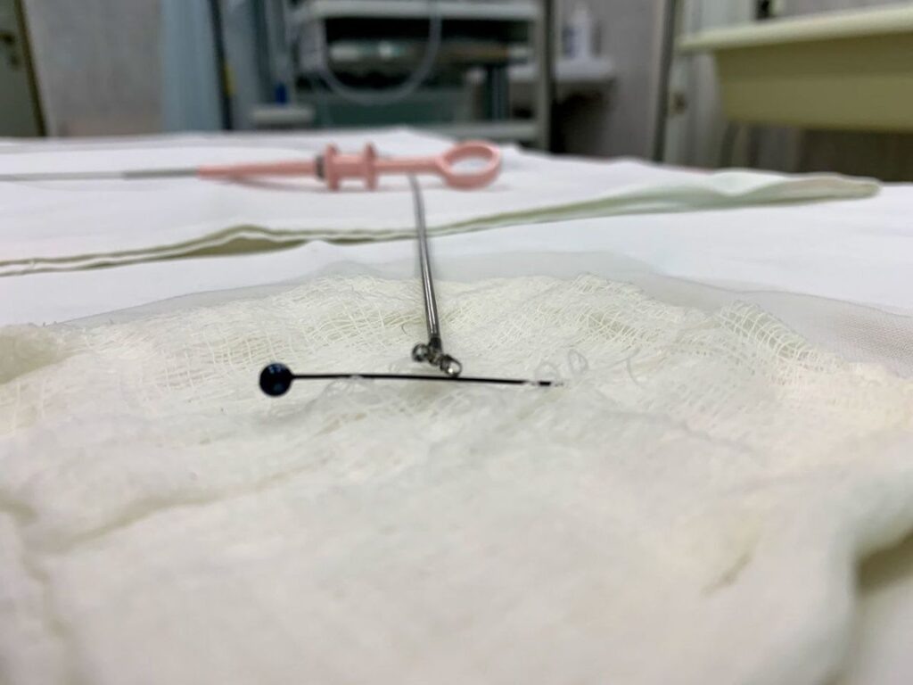    Фото: Минздрав Свердловской области